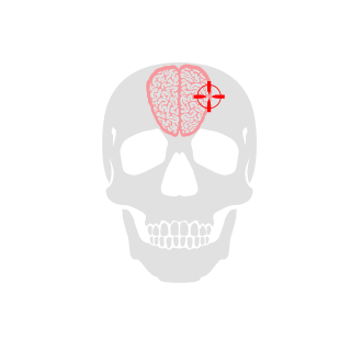 AWPeration8093's emblem