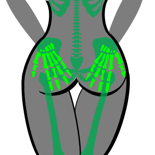 hochmuss's emblem