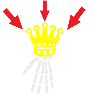_Carl_iboi_f's emblem